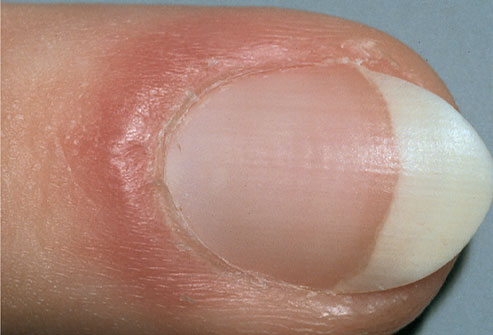 Nails and Health - Blog @ 