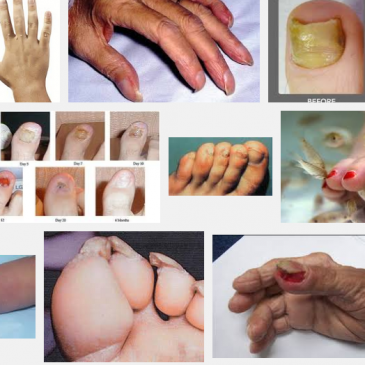 Five Dangers awaiting you at the nail salon