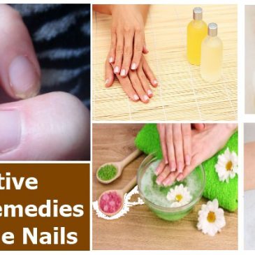 Remedies for brittle fingernails