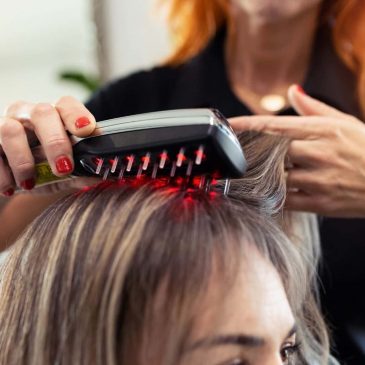 Laser Combs For Thinning Hair
